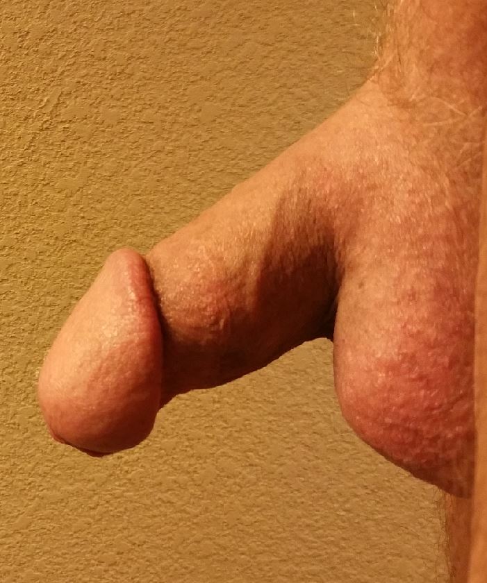 Flaccid 2.JPG