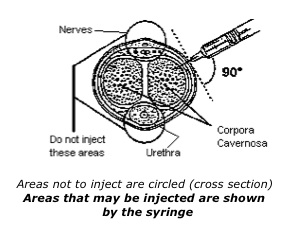 injection_02.jpg