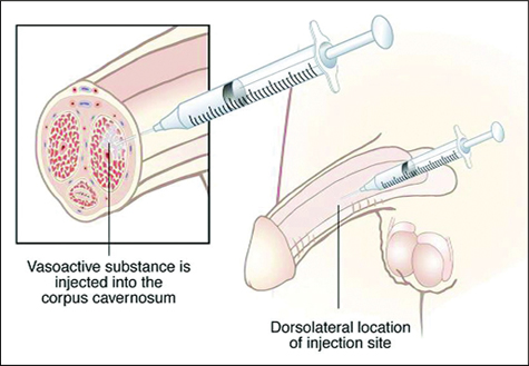 TriMix-Inject-Zone.jpg