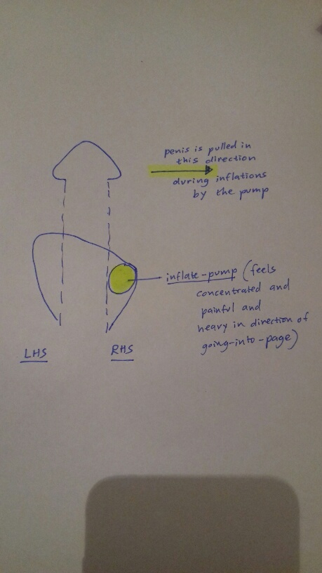 Franktalk_drawn diagram of pump on one side.jpg