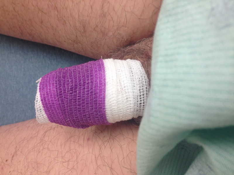 priapism hospital erection bandage.jpg